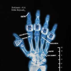 Kobe Bryant Hand X Ray Rings Champion Basketball Fan T Shirt 38337458